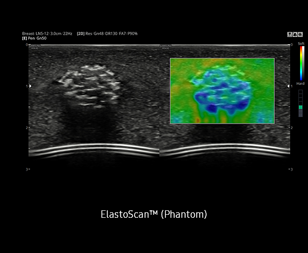 ElastoScan™ Sample