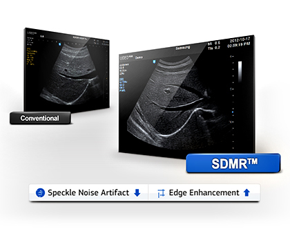 SDMR - szemcsézettség szűrő