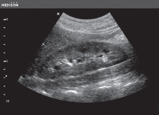 Hasi ultrahang kép - fekete-fehér hordozható ultrahang