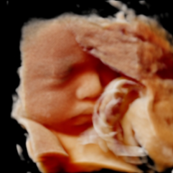 Magzati arc és köldökzsinór fotórealisztikus 3d ultrahang képe