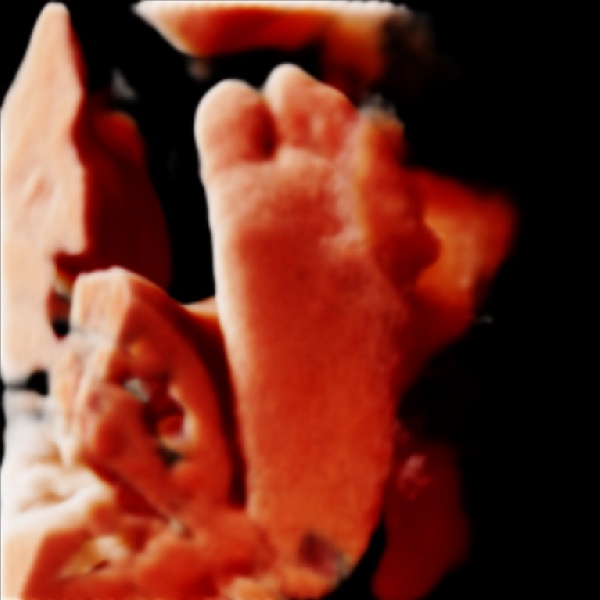 Magzat talpáról készült valósághű 3d ultrahang kép