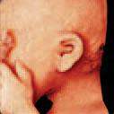 Magzat fülének FRV™ (Realisztikus magzati nézet) képe