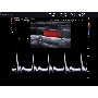 EKO7 MID CCA triplex Doppler ultrahang kép