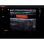 EKO7 vascularis Doppler ultrahang kép 