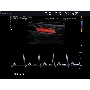 EKO7 triplex Doppler ultrahang kép
