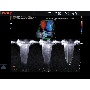 EKO7 CW Doppler ultrahang kép