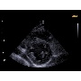 Cardiovascularis ultrahang - Accuvix A30