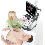 Accuvix XG vascularis vizsgálat