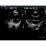 Szív ultrahang képe 2 - MySono U6