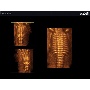 SonoAce R7 magzati gerinc 3D Cine képe