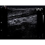 SonoVet R5 demokép 1
