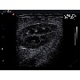SonoVet R5 demokép 2