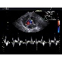 SonoVet R5 demokép 4